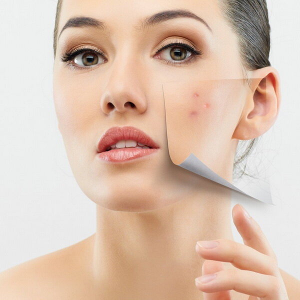 Источник:https://da-vita.ru/beauty-blog/kak-izbavitsya-ot-prishei-ugrei-na-litse.html