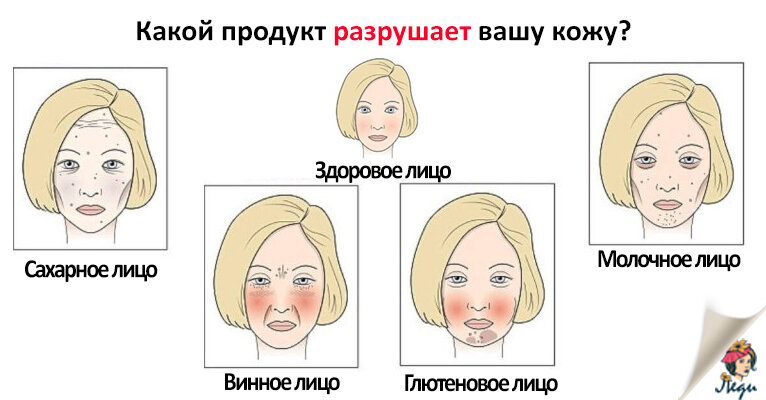 Как выглядит сахарное лицо