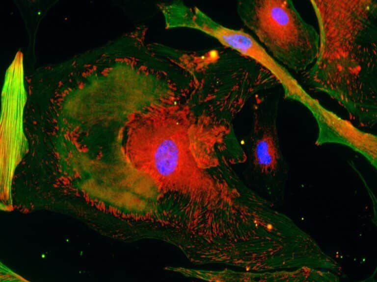 Микрофотография клеток соединительной ткани человека, дифференцировка которых меняется под влиянием внеклеточных везикул, секретированных клетками с отредактированными генами микроРНК / © Наталия Басалова📷
