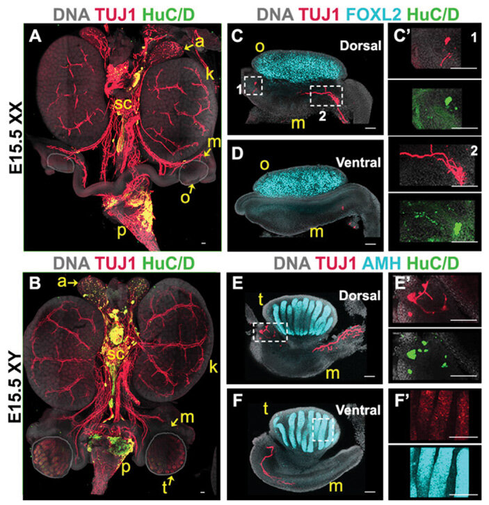 Рис. 2. Распределение нейрональных маркеров TUJ1 (отмечен красным) и HuC, HuD (отмечены зеленым) по гонадам и мезонефросам мышиных эмбрионов в возрасте 15,5 суток (E15.5, embryonic day 15.5). Изображения A, С, C', D — самка (XX), B, E, E', F, F' — самец (XY). Чтобы лучше было видно гонады каждого пола, на A эмбрион показан с дорсальной стороны, на B — с вентральной. Голубым отмечены маркеры типичных клеток половых желез — FOXL2 зернистых клеток яичника и AMH клеток Сертоли семенников. Серым отмечены участки, несущие ДНК (то есть в основном ядра клеток). Пунктиром выделены увеличенные участки (например, E' — изображение области, выделенной белым пунктиром на E). Dorsal — дорсальная, спинная сторона (C, C', E, E'). Ventral — вентральная, брюшная сторона (D, F, F'). Буквами обозначены: o — яичник (ovary), t — семенник (testis), m — мезонефрос (mesonephros), p — таз (pelvis), sc — симпатический ствол (sympathetic chain), k — почка (kidney), a — надпочечник (adrenal gland). Длина масштабных отрезков — 100 мкм. Изображение из обсуждаемой статьи в PNAS