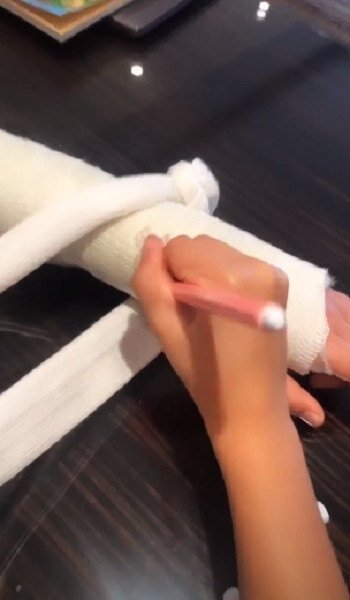 гипс на ручке в начале года