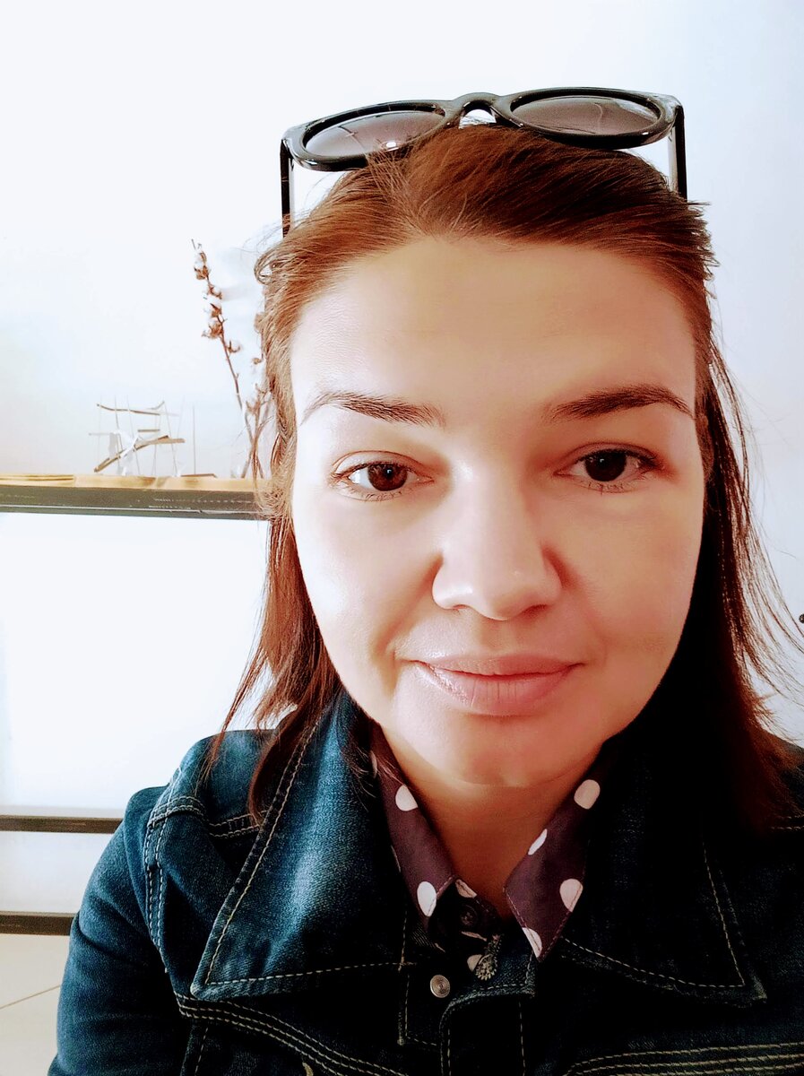 Это фото сделано на утро после дня операции. Немного опухшая после обильных слез накануне, но глаза даже не красные!