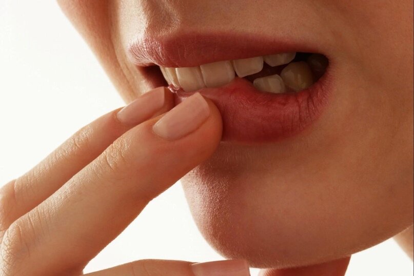 Стоматит: как ускорить заживление?