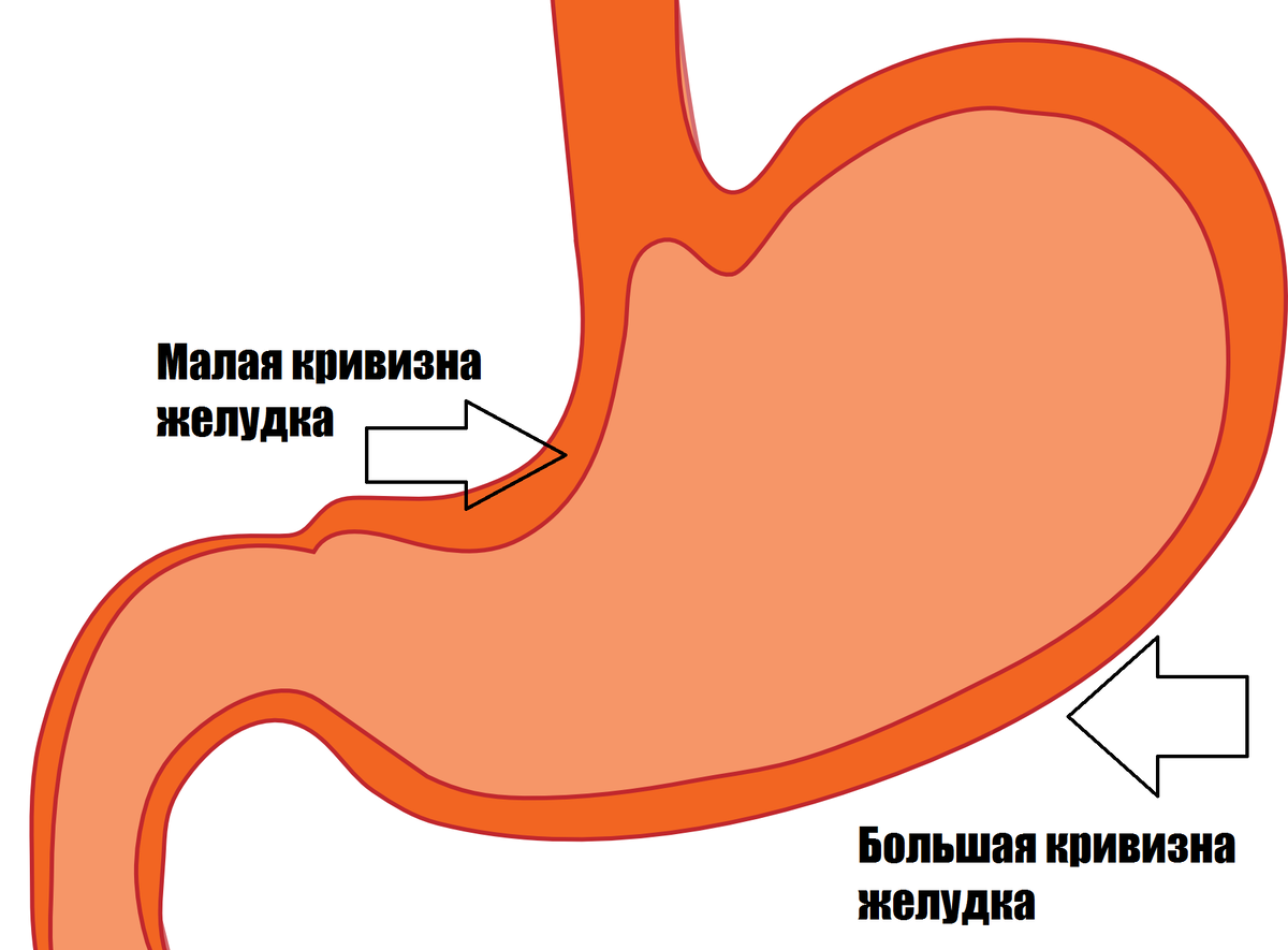 Автор подрисовал стрелочки к картинке с pixabay.com