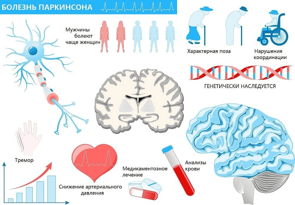 Болезнь Паркинсон и Альцгеймера | ГрибоЕД | Дзен