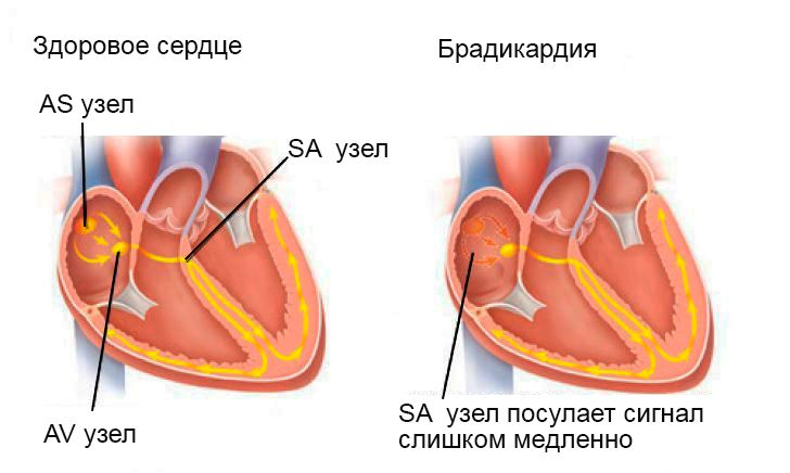 Кардиолог назвал способы корректировки пульса в домашних условиях – Москва 24, 