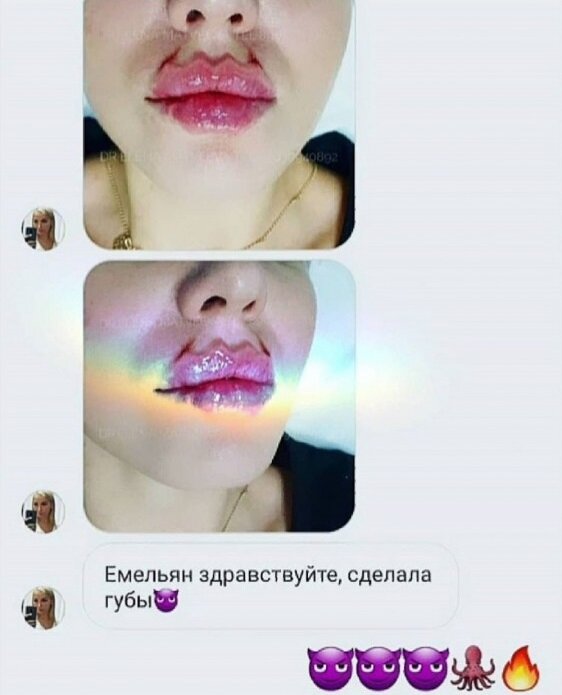 Каоллега Емельяна Брауде сделала"дьявольские губы"  по его совету.