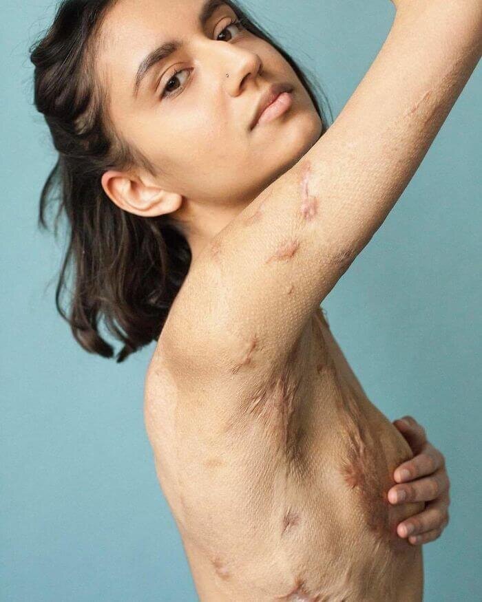 -2