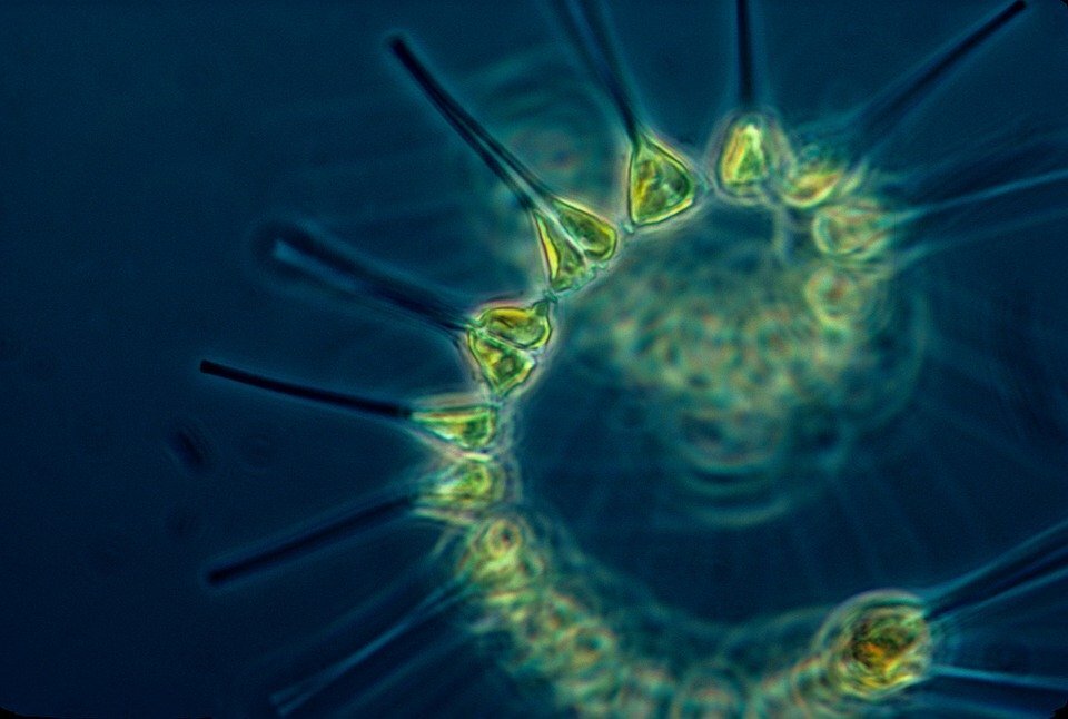 https://cdn.pixabay.com/photo/2016/04/23/23/11/phytoplankton-1348508_960_720.jpg
