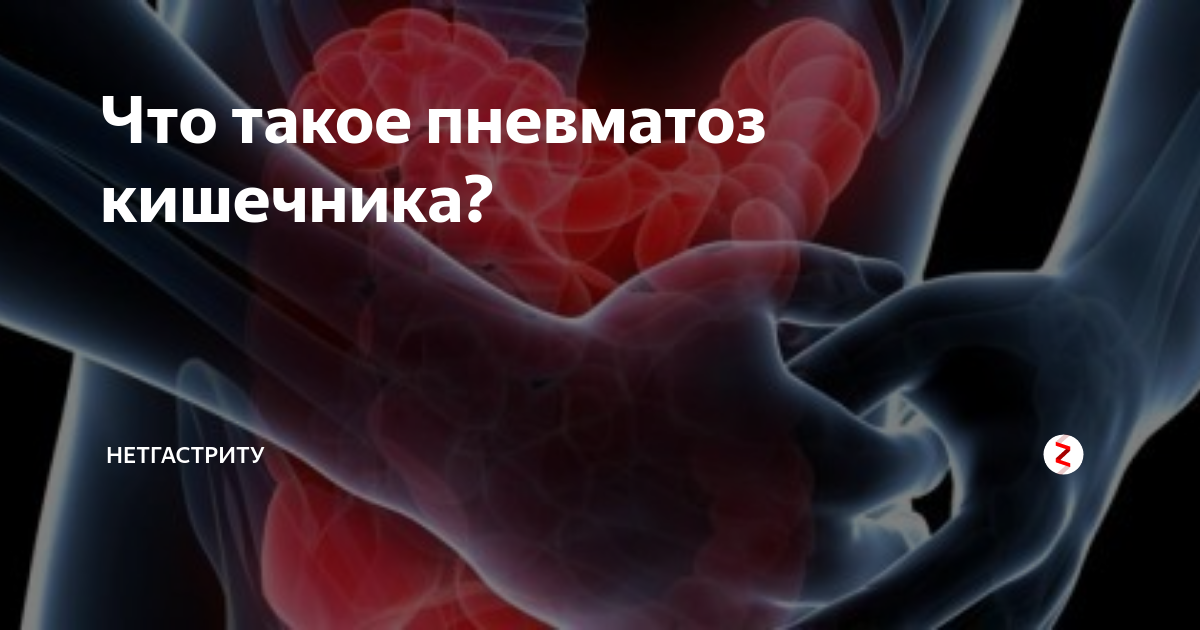 Пневматизация кишечника что это. Повышенный пневматоз кишечника. Повышенная пневматизация Толстого кишечника. Пневматизация ободочной кишки.