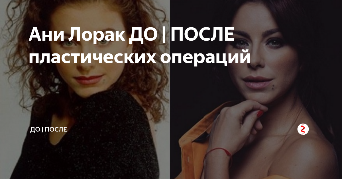 Картинки ЛОРАК ДО ПОСЛЕ