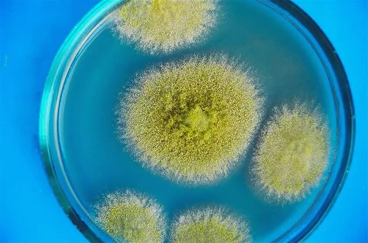 Желтые бактерии. Плесневые грибы аспергиллус. Аспергилл желтый. Aspergillus oryzae грибы. Плесневые грибы аспергилл.