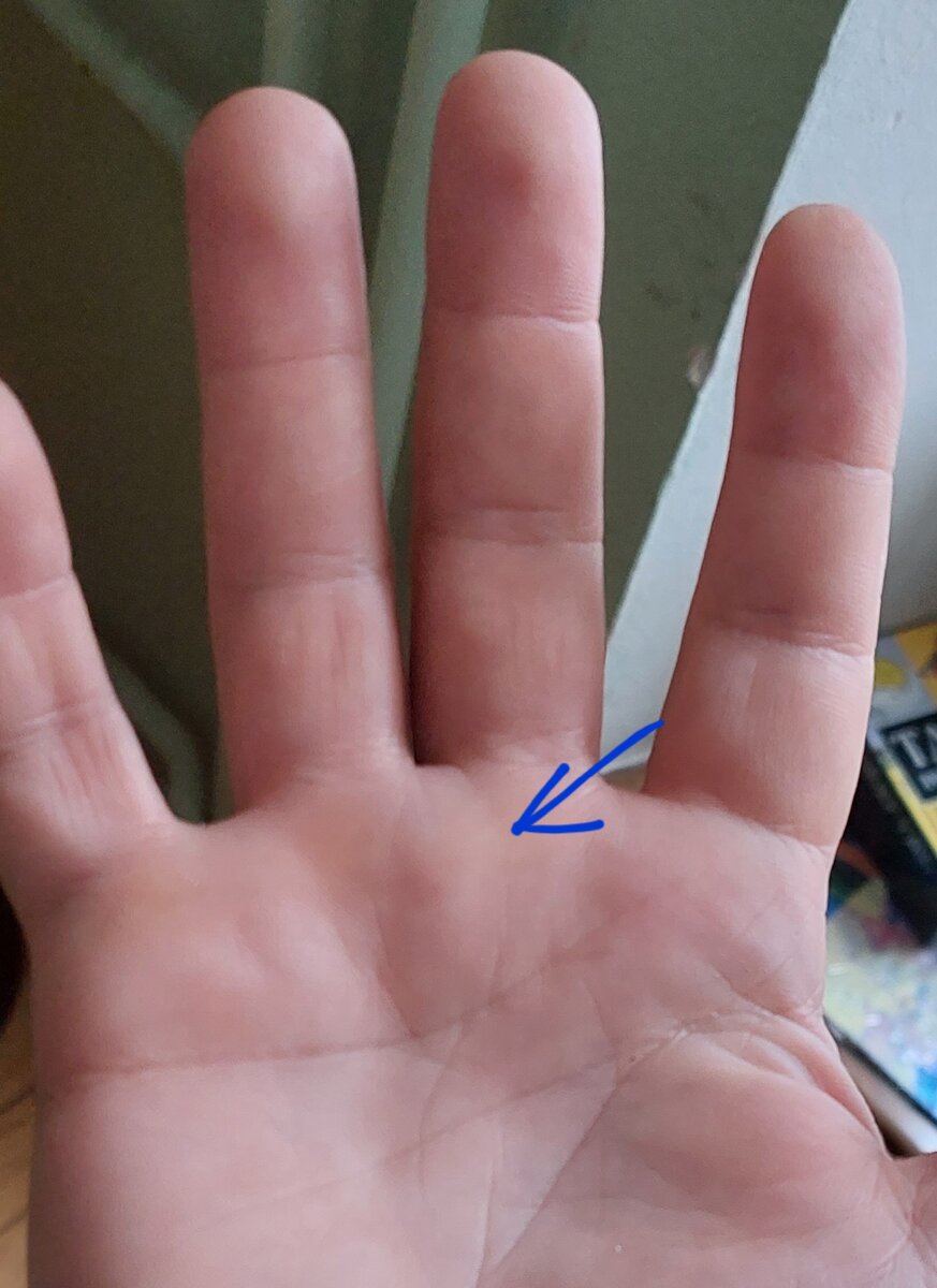 Сильное развитие холма Сатурна