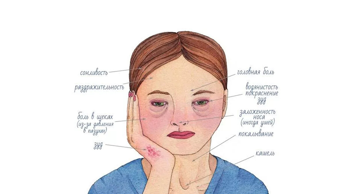 Основные симптомы сезонной аллергии