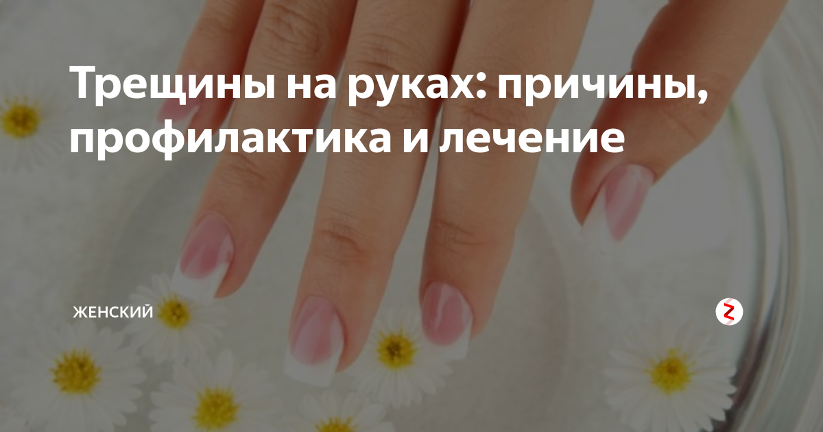 Трещины на руках какие витамины. Трещины на пальцах рук каких витаминов. Трескается кожа на пальцах рук нехватка Витаминовая. Трескается кожа на пальцах рук каких витаминов не хватает.