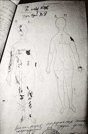 Локализация повреждений тела Виктора Цоя после аварии