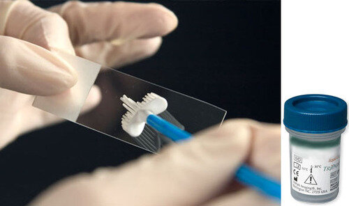 Новые рекомендации дополняют руководство 2012 года и существенно упрощают подходы к этому виду профилактического обследования. 