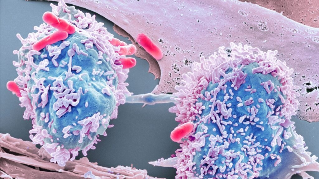 Лечения вагинита