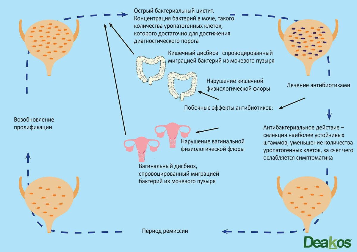 Схема лечения кандидозный цистит