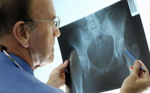  Перевод с постельного режима на полупостельный происходит после контрольного снимка