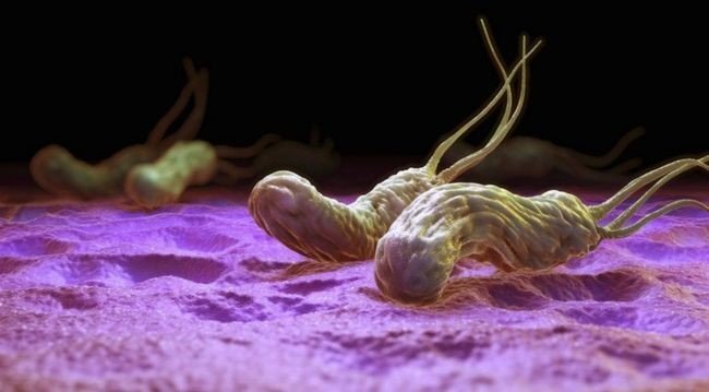 Что такое Helicobacter Pylori и как лечить Хеликобактер в домашних условиях без антибиотиков?