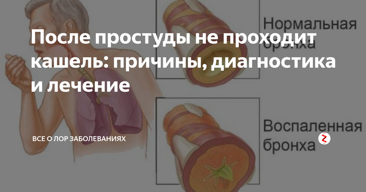 Кашель не проходит у взрослого причины. Кашель не проходит. Долго не проходит кашель. Кашель после простуды