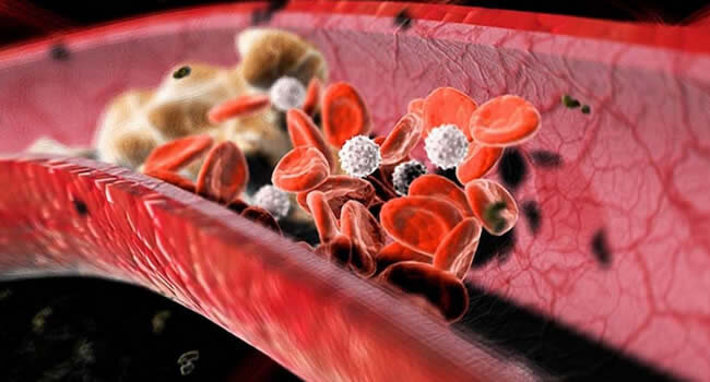 Много холестерина содержится в жирных  мясных и молочных продуктах: в свинине, сыре, сливочном масле, жирном  твороге, корейке и копченостях, говядине, птице, рыбе, в 3-процентном  молоке. Очень богаты холестерином субпродукты, особенно мозги, и желток  куриного яйца. Именно их употребление и следует ограничить.
Есть  данные, что имеющиеся во многих растениях органические кислоты  нормализуют обмен углеводов, сдерживая превращение их в жиры и  образование холестерина. Такой способностью обладает, в частности,  тартроновая кислота, которая есть во многих овощах и фруктах, особенно в  капусте, яблоках, айве, грушах, моркови, редисе, помидорах, огурцах,  смородине.
