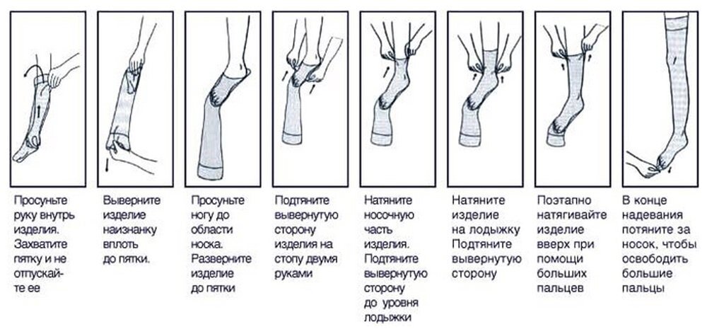 Схема одевания компрессионных чулок