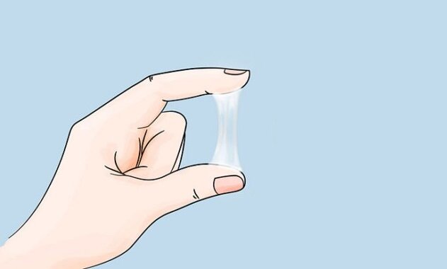 Фото из открытых источников: цервикальная слизь