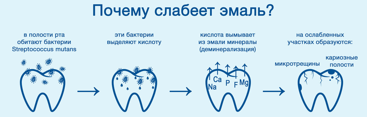Кислоты полости рта. Реминерализация зубов схема. Причины кариеса зубов схема. Стадии кариеса молочных зубов схема.