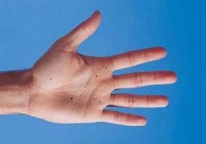 Отметки на теле люди расценивают знаками свыше, а родинка на левой ладони указывает на события: