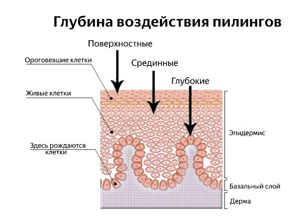 Поверхностные пилинги работают в верхних слоях эпидермиса, срединные затрагивают слои живых клеток (выполняются косметологом), глубокие - частично повреждают базальную мембрану (это полноценная операция, которая проводится под наркозом)