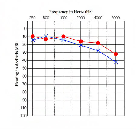Аудиограмма. Картинка из интернета