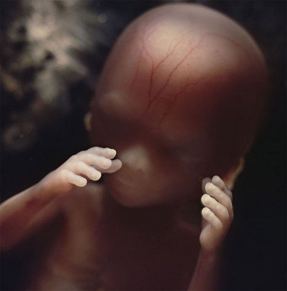 Фото эмбрион человека 10 недель фото