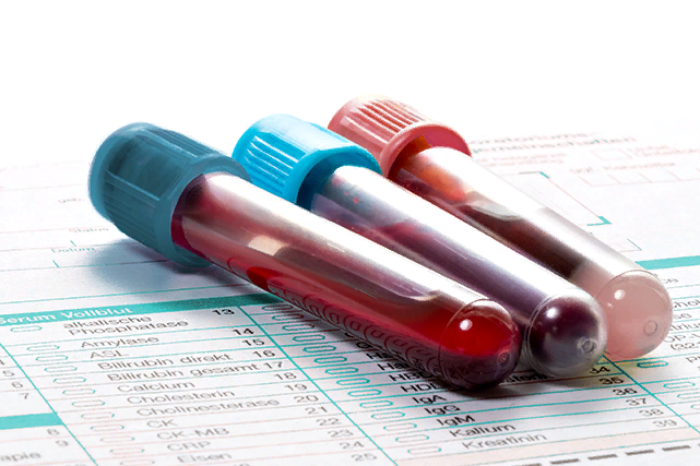 В какой лаборатории лучше делать анализ крови?