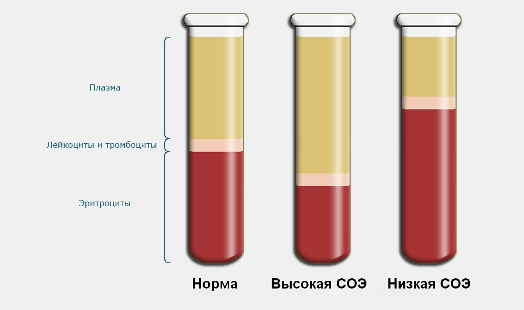 Гематокрит повышен у женщины 60 что это. Кровь плазма гематокрит. Гематокрит пробирка. Гематокрит 50.7. Гематокрит 49.1.