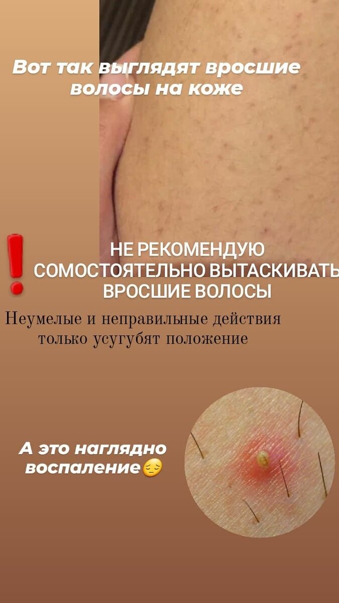 Между ног волосатая 