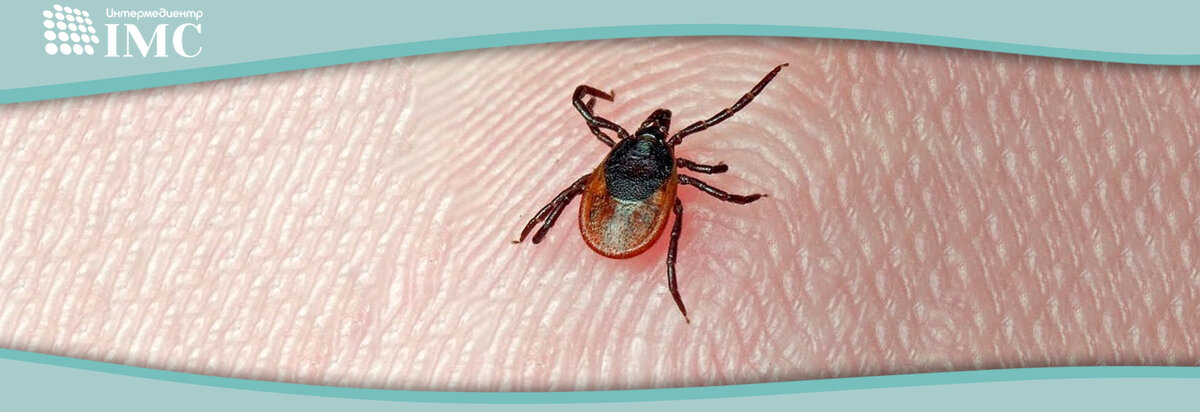 Клещевой менингоэнцефалит — вирусная инфекция, поражающая центральную и периферическую нервную систему.