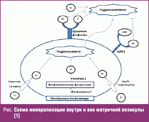 Щелочная фосфатаза кости. Гипофосфатазия патогенез. Минерализация схема. Матричные везикулы. Схема минерализации кости.