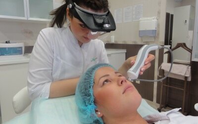 RF лифтинг лица