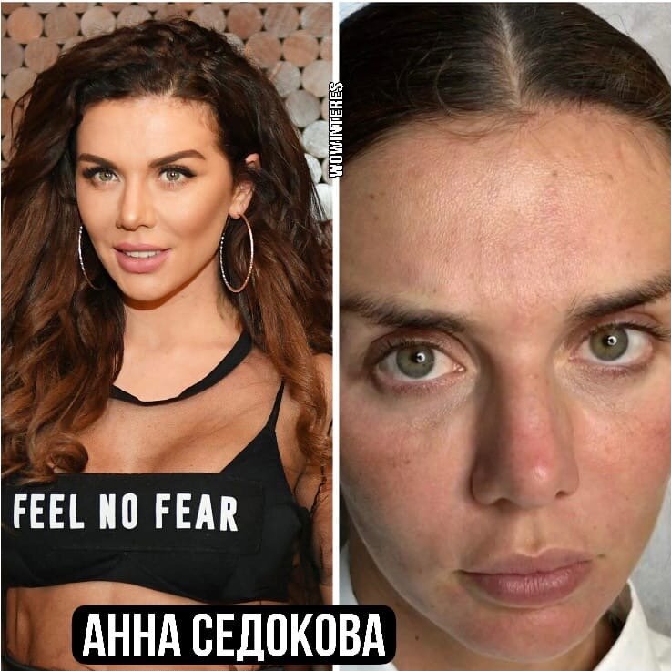 Анна Седокова без макияжа
