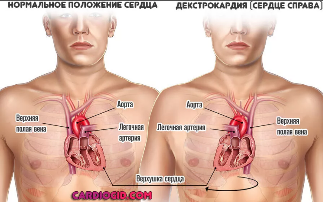 Где находится то есть. С какойтстороныт серцн. Где сердце у человека