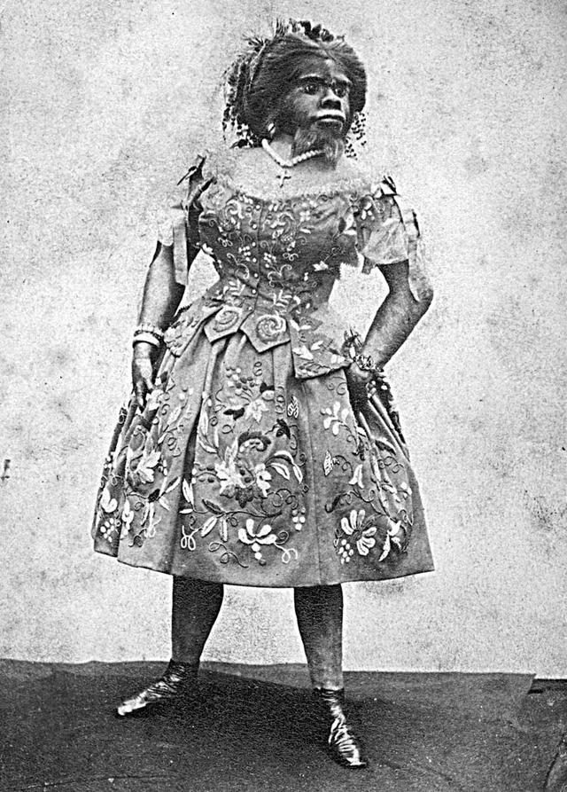 источник фото https://www.peoples.ru/state/citizen/julia_julia_pastrana/