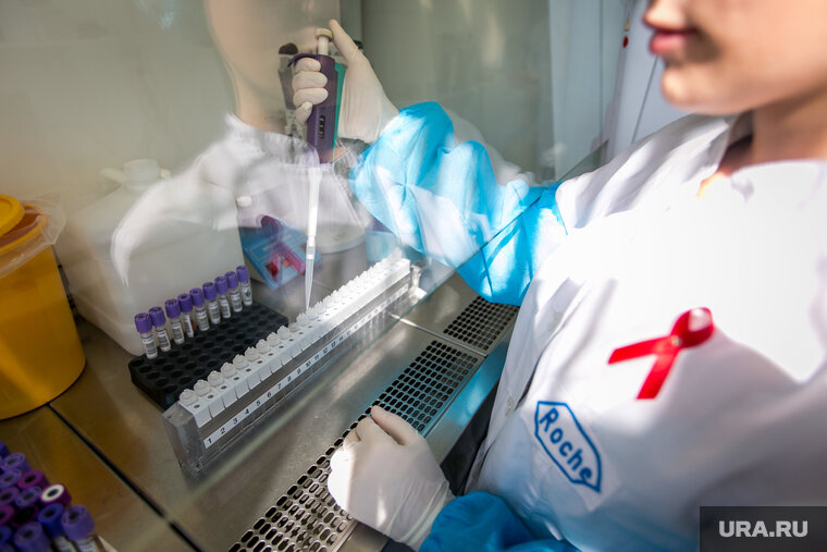    В 2021 году охват населения на предмет заболеваемости ВИЧ-инфекцией составил более 84%