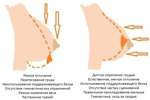 Изменения возникающие у женщины в груди во время беременности.