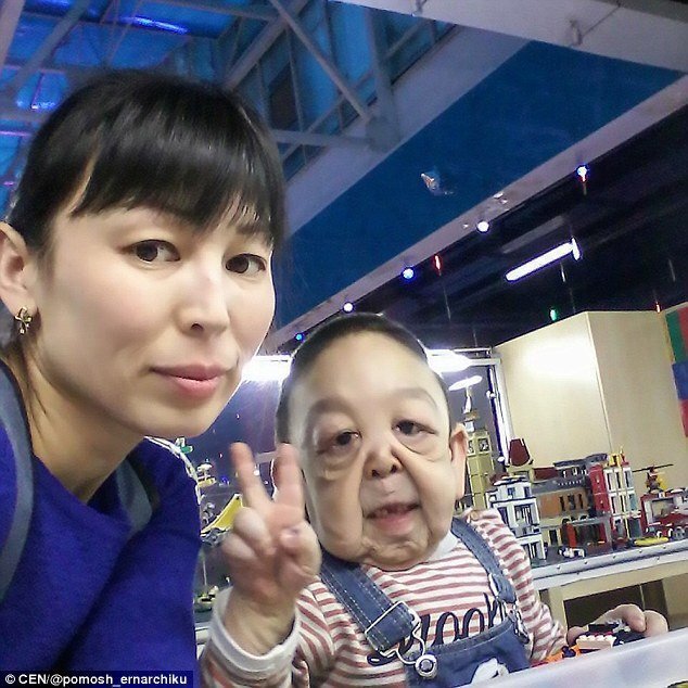  Лечение непрерывное и дорогостоящее. Мама ребенка собирает деньги на лечение в соцсетях — в частности, в Инстаграме.