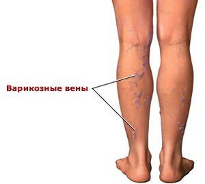 flebologiya-clinic.ru