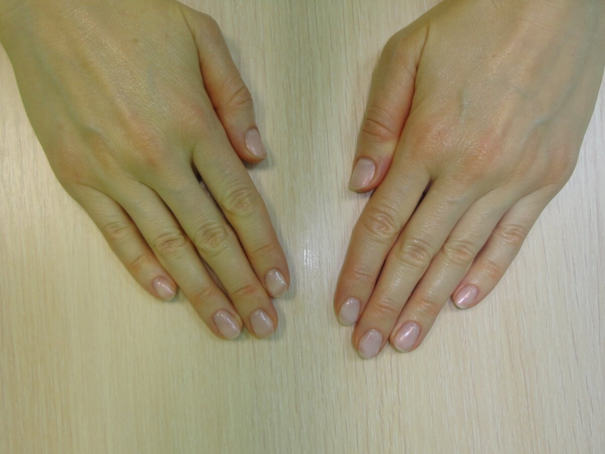 После применения масла ромашки (Фото из личного архива)