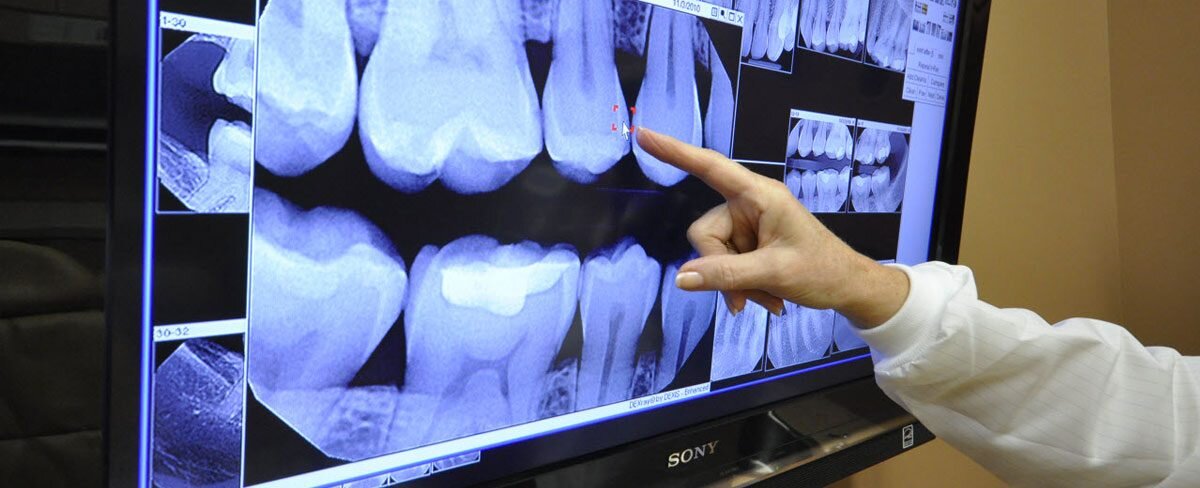 Зачем стоматологи просят переделать заново рентгеновские снимки