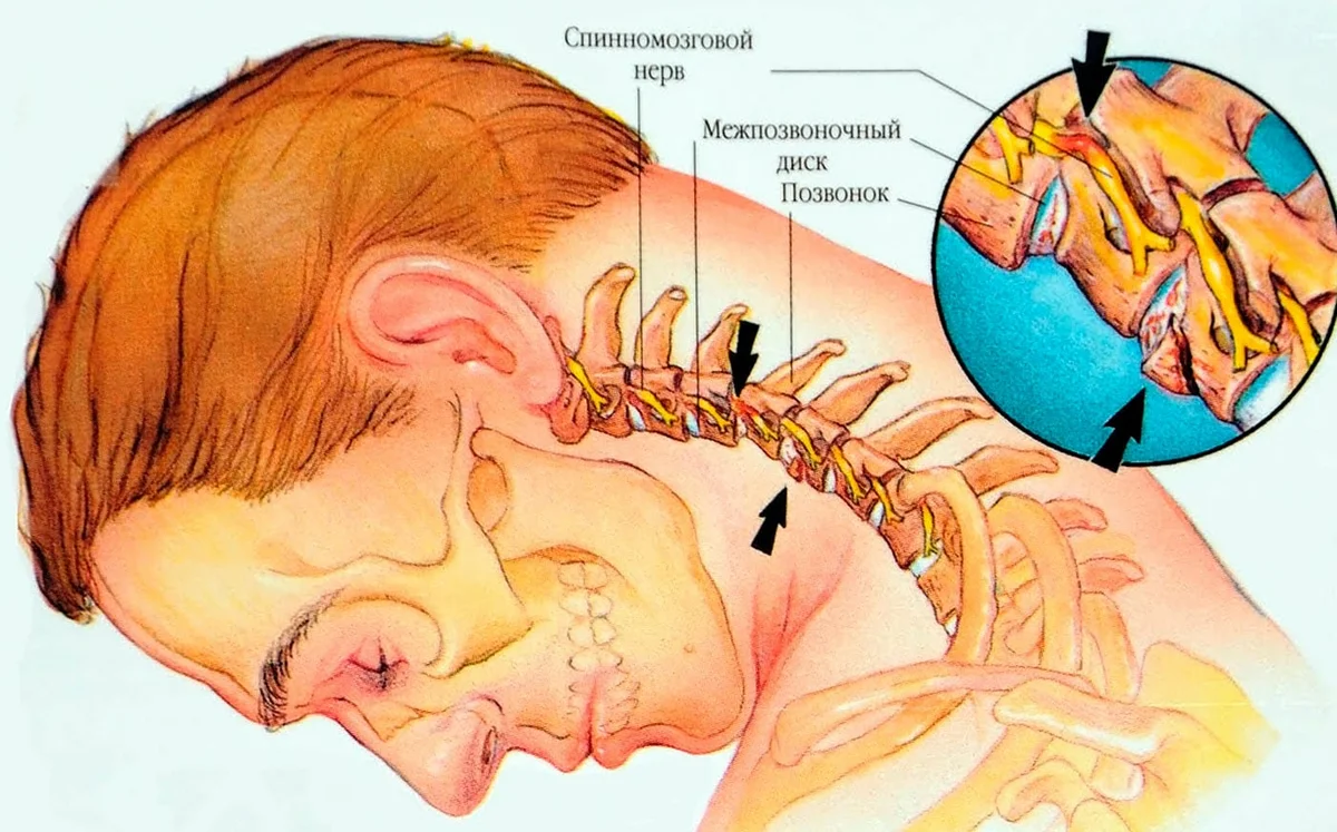 Если болит шея